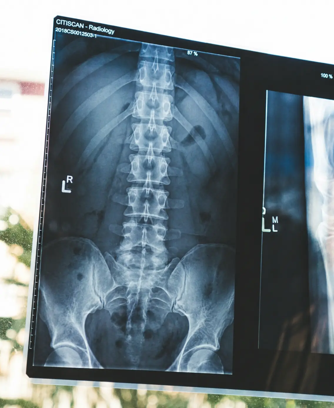 MRI検査・画像診断のイメージ 腰痛診療ガイドライン 銀座YRクリニック