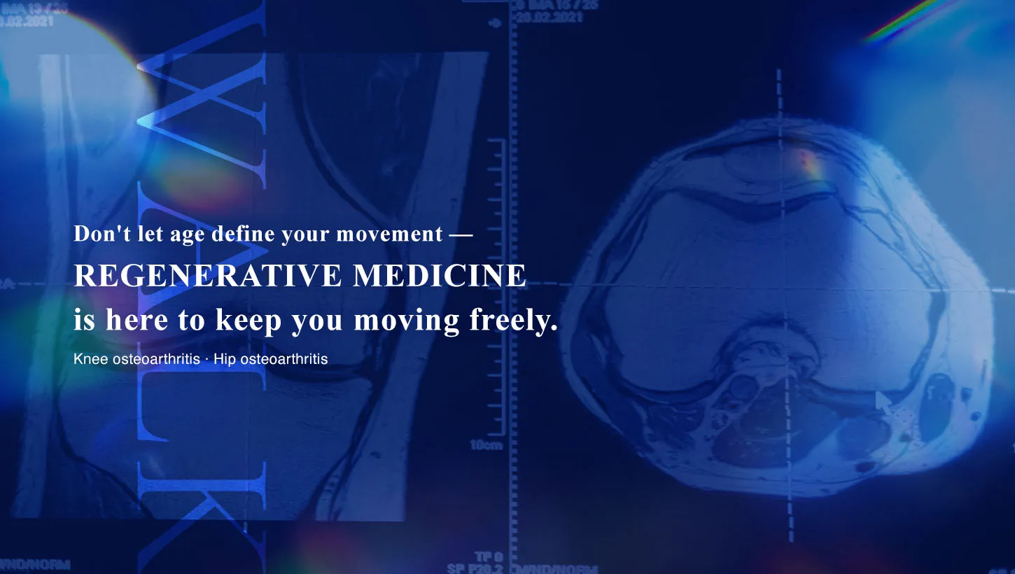 Regenerative medicine for osteoarthritis of the knee and hip in Ginza Tokyo｜YR Clinic