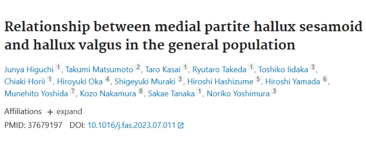 なぜ外反母趾になる？約2,000人の研究で分かった種子骨との関係？|樋口淳也院長の研究をわかりやすく解説